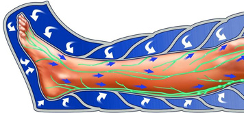 imagen de presoterapia